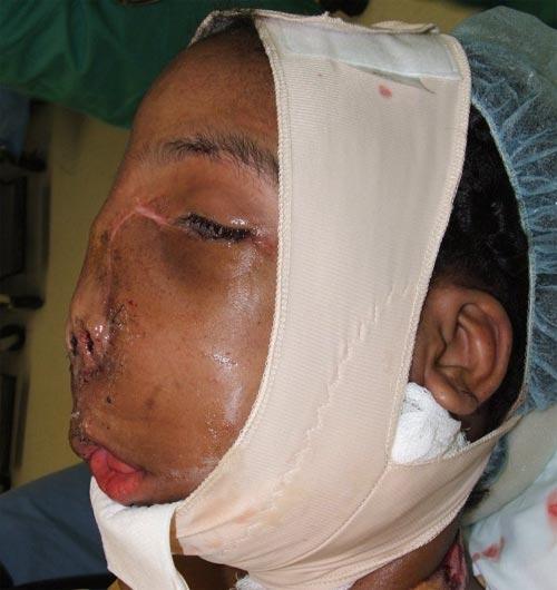 Самые гигантские опухоли на теле человека