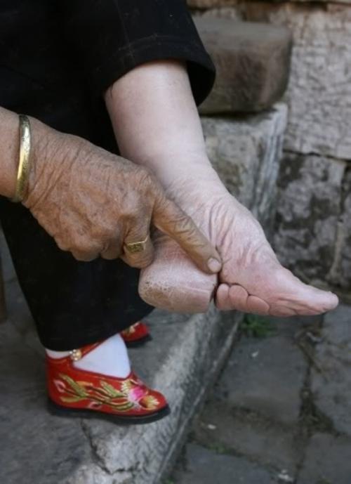 Бинтование ног в Китае: шокирующая традиция