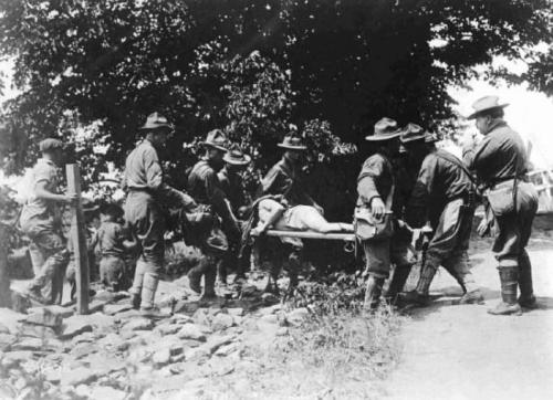 Кадры, не прошедшие цензуру в период Первой мировой войны