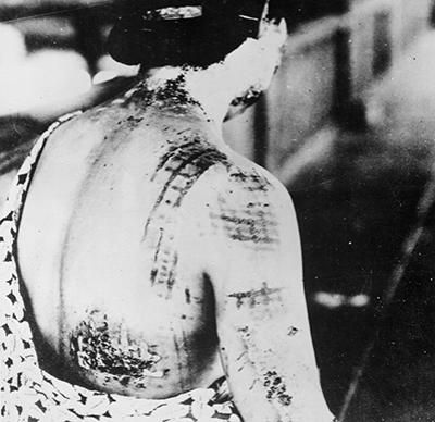34 страшных кадра в память о Хиросиме