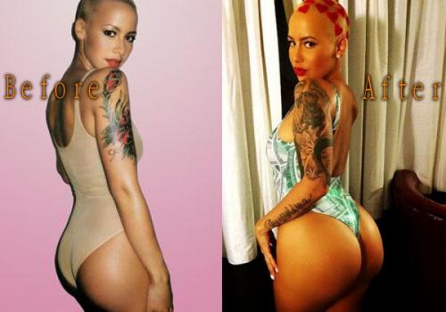 Знаменитости, которых уличили в увеличении груди и ягодиц