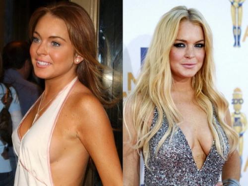 Знаменитости, которых уличили в увеличении груди и ягодиц