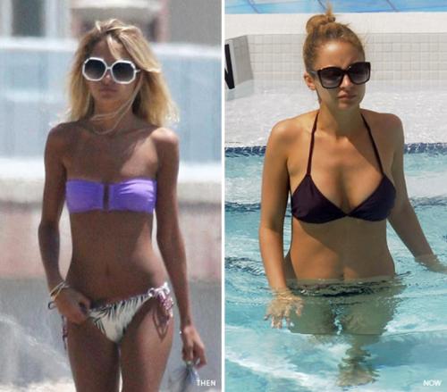 Знаменитости, которых уличили в увеличении груди и ягодиц