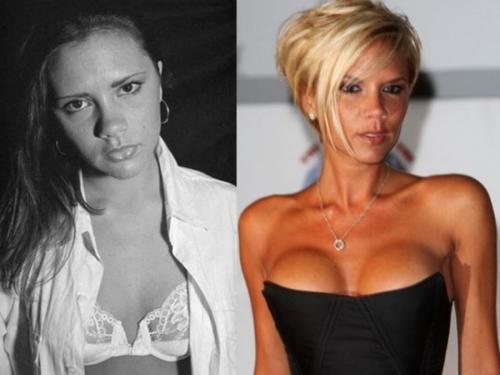 Знаменитости, которых уличили в увеличении груди и ягодиц