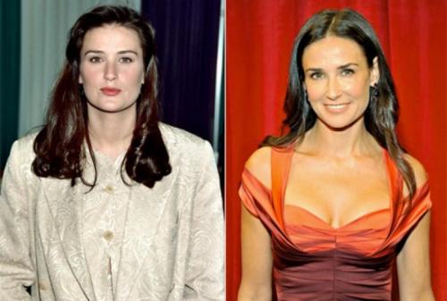 Знаменитости, которых уличили в увеличении груди и ягодиц