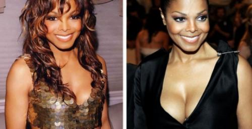 Знаменитости, которых уличили в увеличении груди и ягодиц