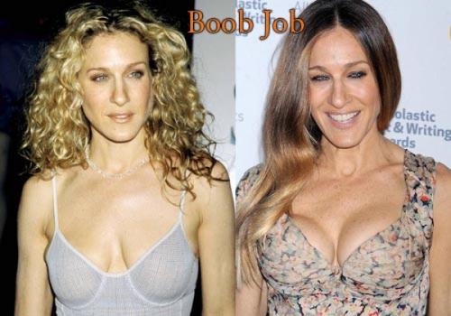 Знаменитости, которых уличили в увеличении груди и ягодиц