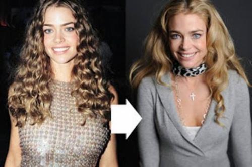 Знаменитости, которых уличили в увеличении груди и ягодиц