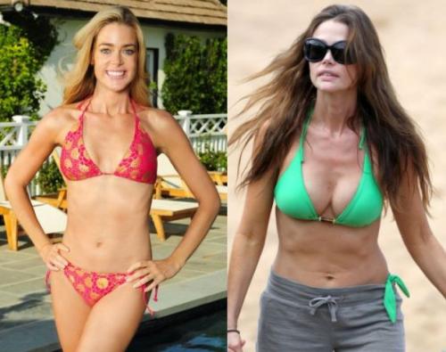 Знаменитости, которых уличили в увеличении груди и ягодиц