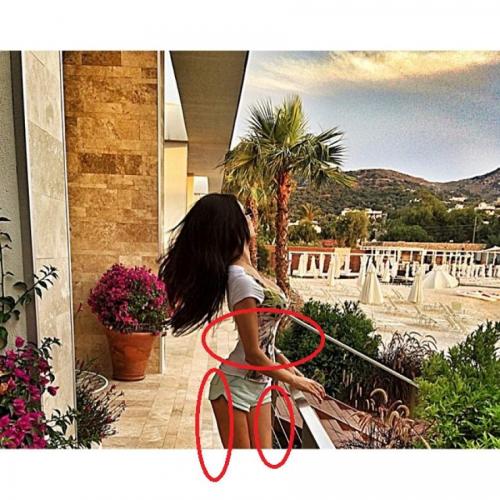 Российские звезды, которые злоупотребляют фотошопом