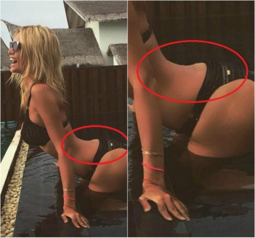 Российские звезды, которые злоупотребляют фотошопом