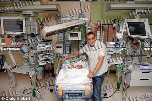 В Англии родились сиамские близнецы сросшиеся грудью