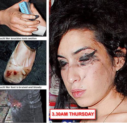 Эми Вайнхауз подралась с мужем