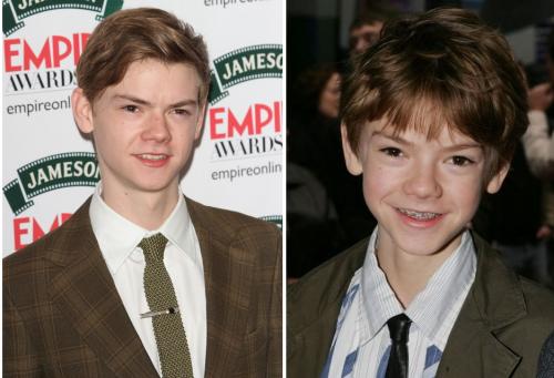 Знаменитости, которые носили брекеты