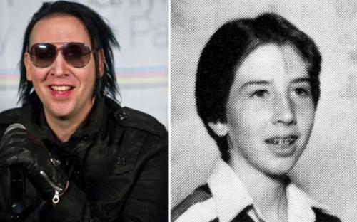 Знаменитости, которые носили брекеты