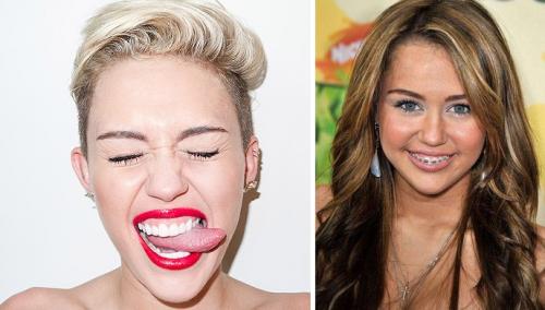 Знаменитости, которые носили брекеты