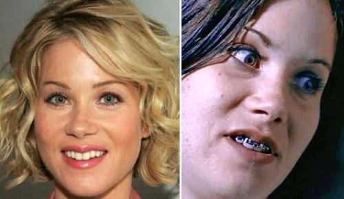 Знаменитости, которые носили брекеты