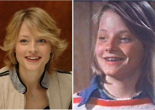 Знаменитости, которые носили брекеты