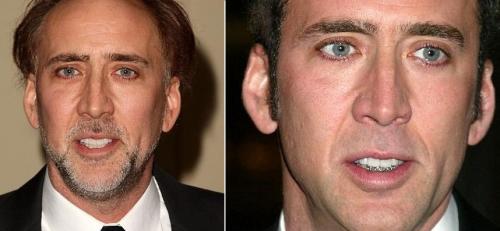 Знаменитости, которые носили брекеты