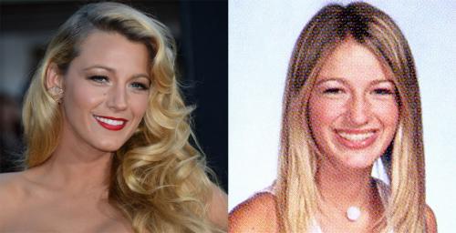 Знаменитости, которые носили брекеты