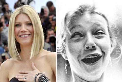 Знаменитости, которые носили брекеты