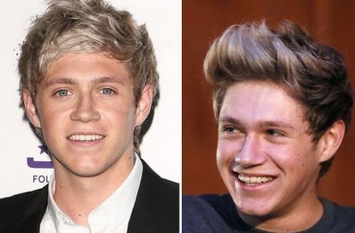 Знаменитости, которые носили брекеты