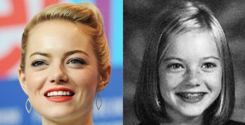 Знаменитости, которые носили брекеты