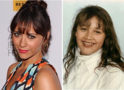 Знаменитости, которые носили брекеты