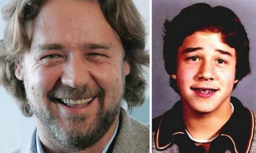 Знаменитости, которые носили брекеты