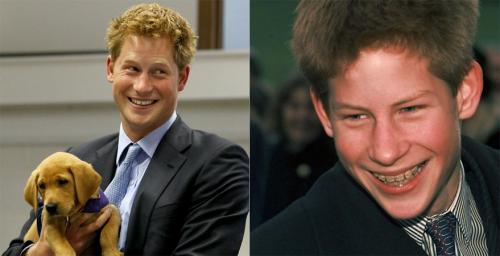 Знаменитости, которые носили брекеты