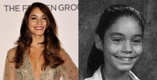 Знаменитости, которые носили брекеты