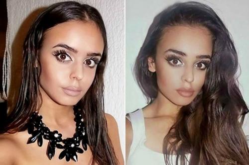 15 самых жутких реальных историй о близнецах