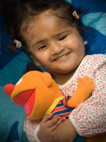 Врачи разделили мозг сиамских близнецов