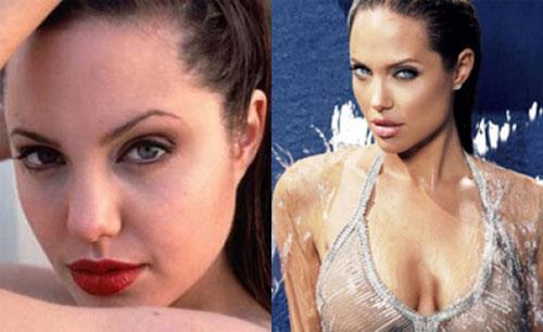 Самые лучшие исправленные носы: эволюция звездных лиц