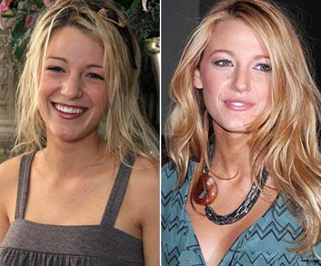 Самые лучшие исправленные носы: эволюция звездных лиц