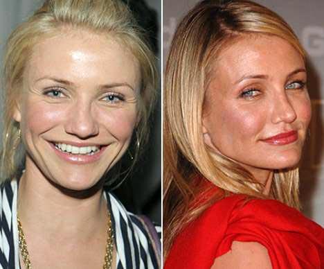 Самые лучшие исправленные носы: эволюция звездных лиц