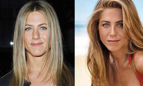 Самые лучшие исправленные носы: эволюция звездных лиц