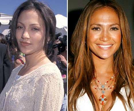 Самые лучшие исправленные носы: эволюция звездных лиц