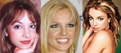 Самые лучшие исправленные носы: эволюция звездных лиц