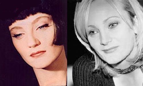 Самые лучшие исправленные носы: эволюция звездных лиц