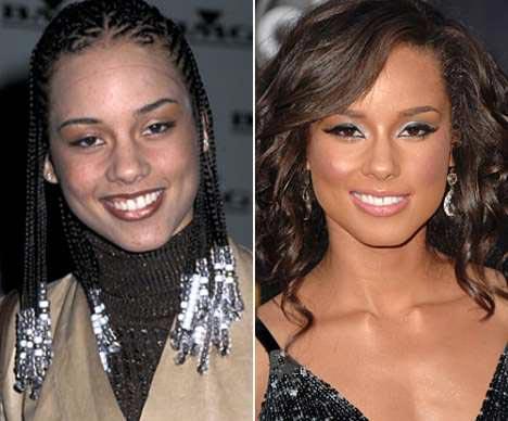 Самые лучшие исправленные носы: эволюция звездных лиц