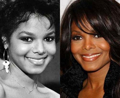 Самые лучшие исправленные носы: эволюция звездных лиц