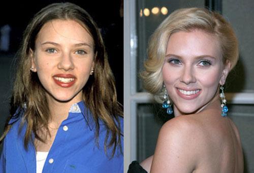 Самые лучшие исправленные носы: эволюция звездных лиц