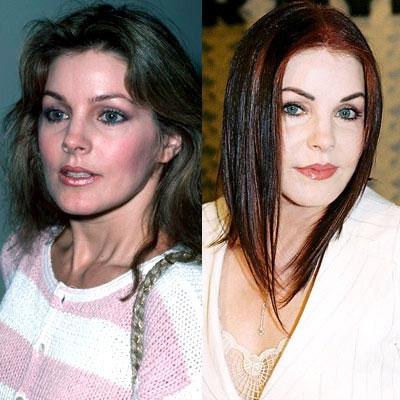 Знаменитости до и после пластической операции: почувствуйте разницу