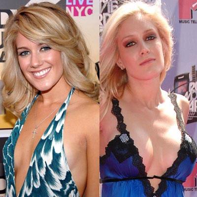 Знаменитости до и после пластической операции: почувствуйте разницу