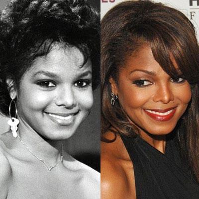 Знаменитости до и после пластической операции: почувствуйте разницу