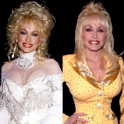 Знаменитости до и после пластической операции: почувствуйте разницу