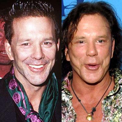 Знаменитости до и после пластической операции: почувствуйте разницу