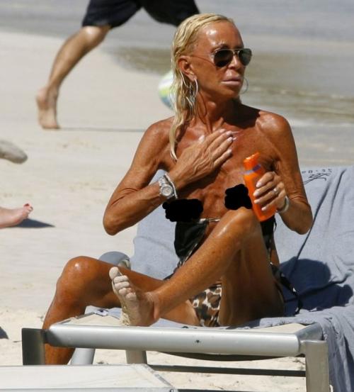 Знаменитости, которые переборщили с автозагаром