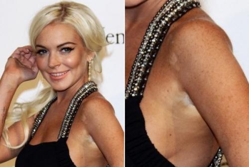 Знаменитости, которые переборщили с автозагаром